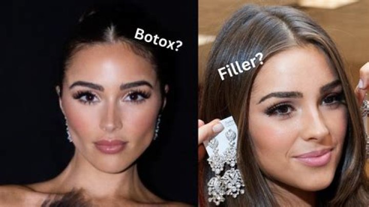 Here’s The Real Reason Why Olivia Culpo Got Plastic Surgery