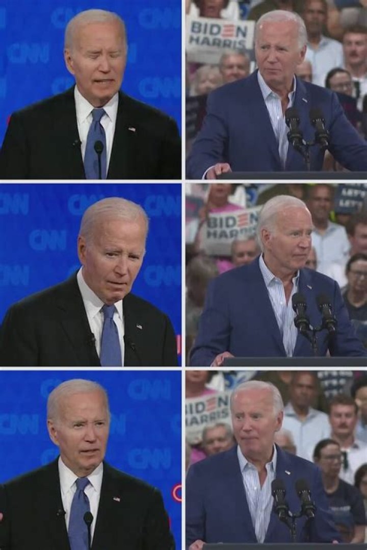 
What Happened To Bidens Head? People Have Questions After They See Bruises On His Forehead 